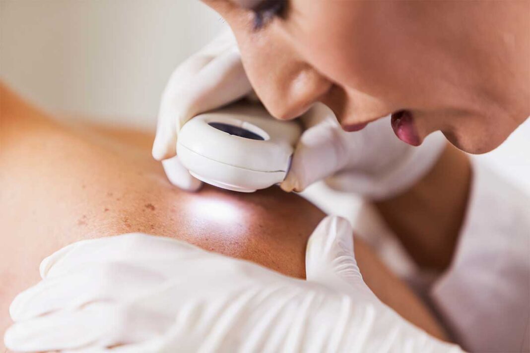 Benefits of Using a Dermatology EHR?